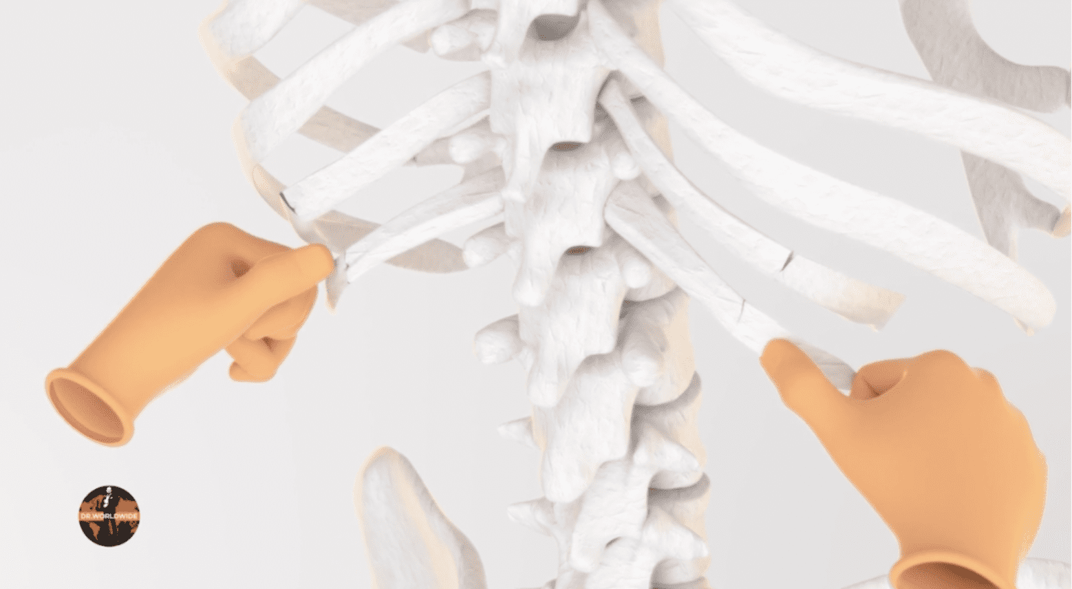 How Is Rib cage Narrowing Done? - Plastic Surgeon